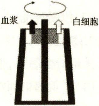第二節(jié) 血液凈化治療原理